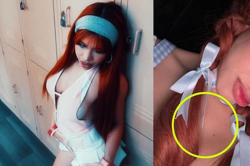 Yeri Mua confiesa tener terrible enfermedad en la piel ¿Es viruela del mono?