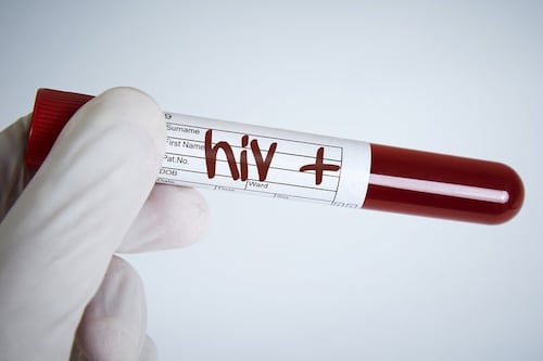 Paciente con leucemia se convierte en la primera mujer curada del VIH tras un trasplante de células madre