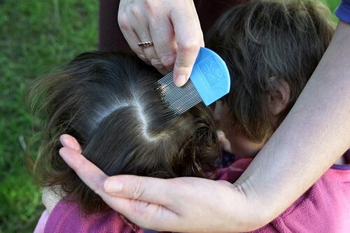 VIDEO: Niña llevaba meses con piojos, le llegaban al cuello y tenía huevos encima de sus orejas