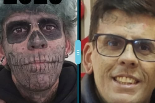 ¡Irreconocible! El hombre más tatuado de Brasil se borra más de 170 tatuajes y así luce