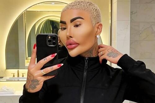 Muere reconocido influencer que quería verse como Kim Kardashian: Falleció tras operarse