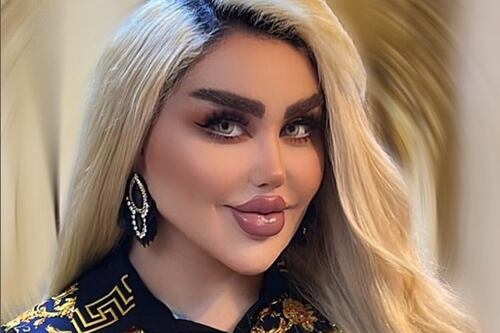 Mujer se hizo más de 40 cirugías para verse como Barbie