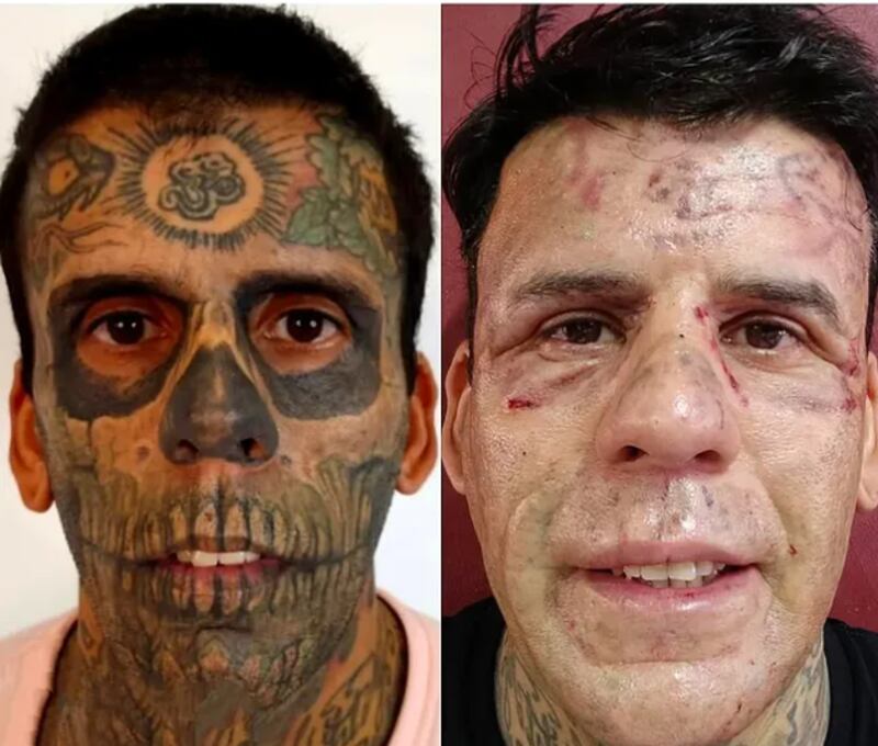Antes y después de Leandro de Souza