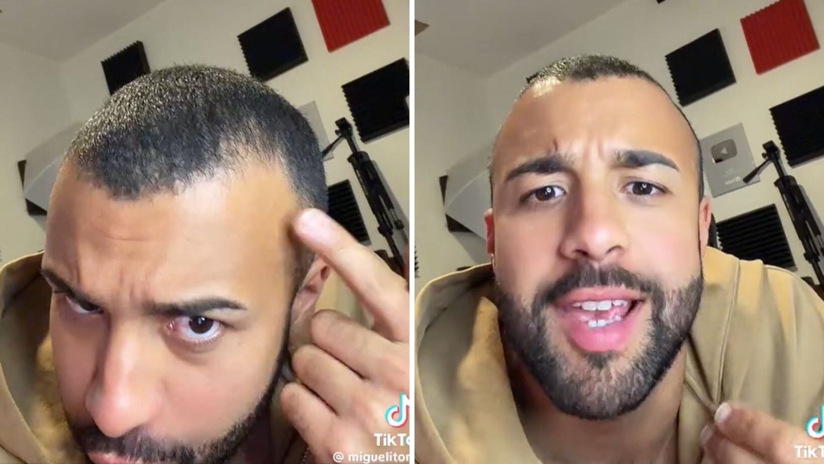 Miguelito resultó ser “El Heredero” de la calvicie en el género urbano